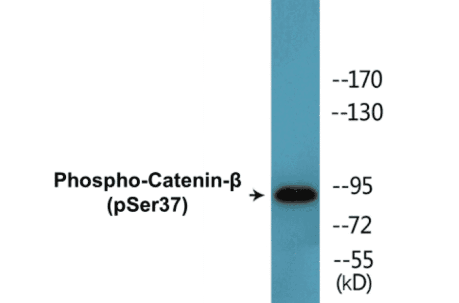 Western Blot - beta Catenin (phospho Ser37) Cell Based ELISA Kit (CBP1503) - Antibodies.com