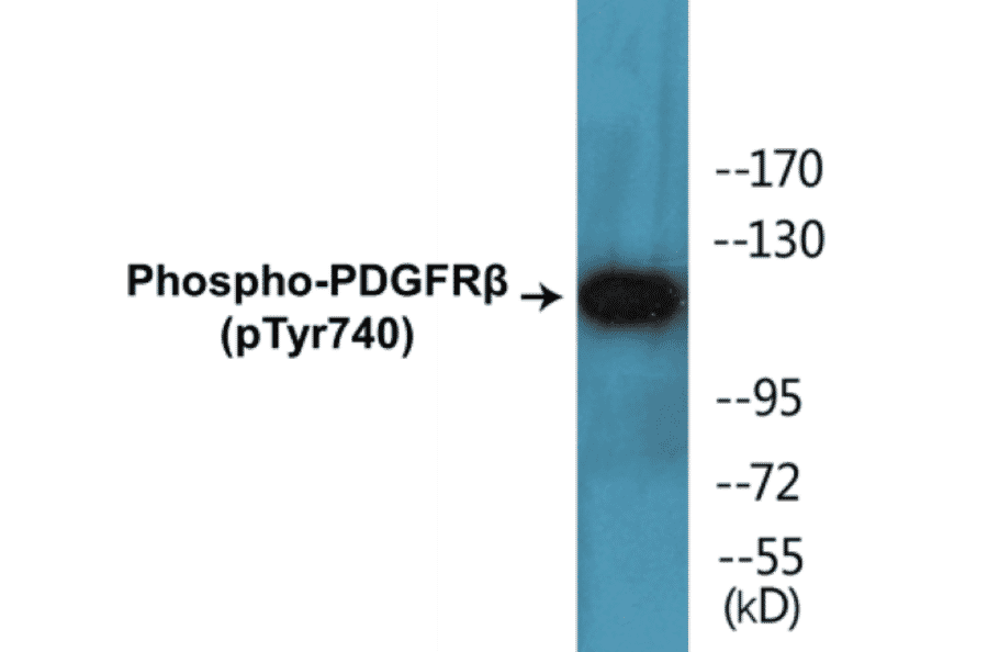 Western Blot - PDGFR beta (phospho Tyr740) Cell Based ELISA Kit (CBP1387) - Antibodies.com