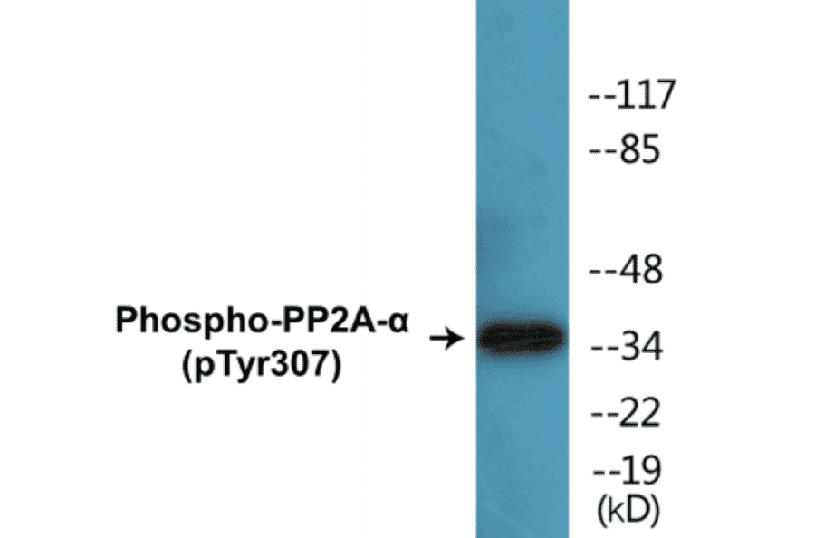 Western Blot - PP2A alpha (phospho Tyr307) Cell Based ELISA Kit (CBP1204) - Antibodies.com