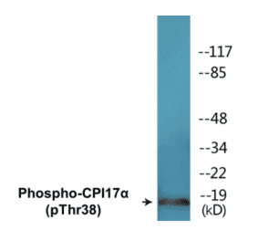 Western Blot - CPI17 alpha (phospho Thr38) Cell Based ELISA Kit (CBP1525) - Antibodies.com