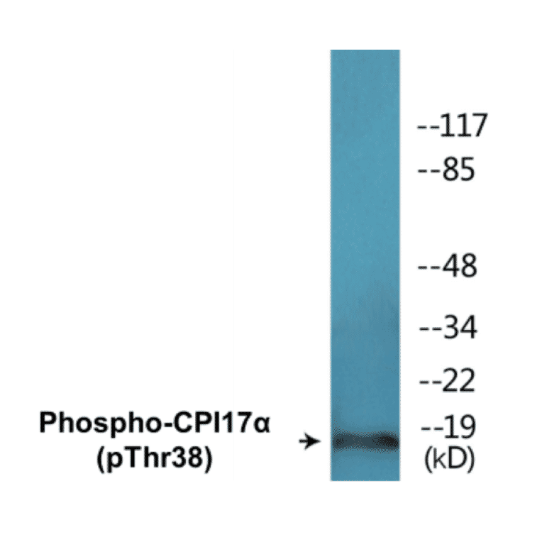 Western Blot - CPI17 alpha (phospho Thr38) Cell Based ELISA Kit (CBP1525) - Antibodies.com