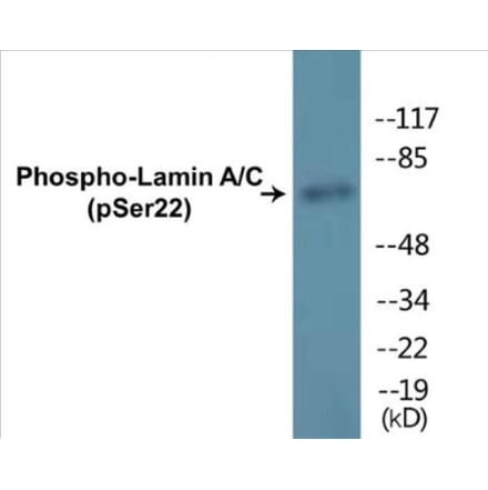 Western Blot - Lamin A + C (phospho Ser22) Cell Based ELISA Kit (CBP1850) - Antibodies.com