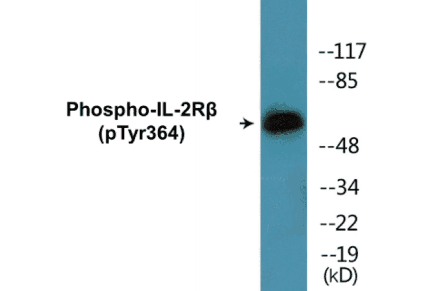 Western Blot - IL-2R beta (phospho Tyr364) Cell Based ELISA Kit (CBP1419) - Antibodies.com
