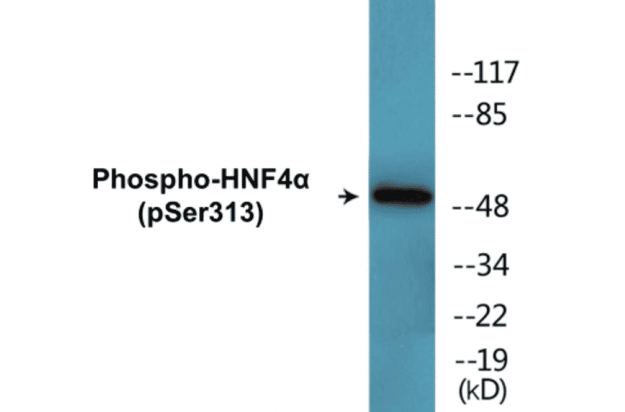 Western Blot - HNF4 alpha (phospho Ser313) Cell Based ELISA Kit (CBP1577) - Antibodies.com