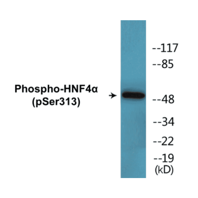 Western Blot - HNF4 alpha (phospho Ser313) Cell Based ELISA Kit (CBP1577) - Antibodies.com