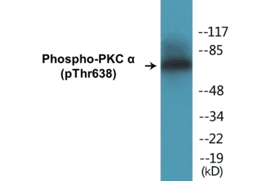 Western Blot - PKC alpha (phospho Thr638) Cell Based ELISA Kit (CBP1274) - Antibodies.com