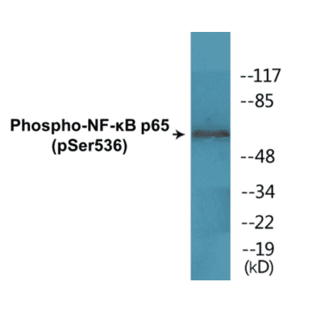 Western Blot - NF-kB p65 (phospho Ser536) Cell Based ELISA Kit (CBP1633) - Antibodies.com