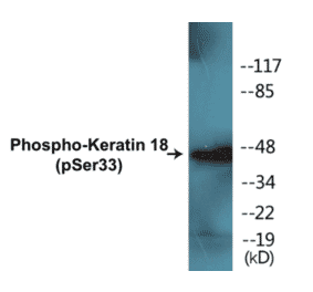 Western Blot - Keratin 18 (phospho Ser33) Cell Based ELISA Kit (CBP1016) - Antibodies.com