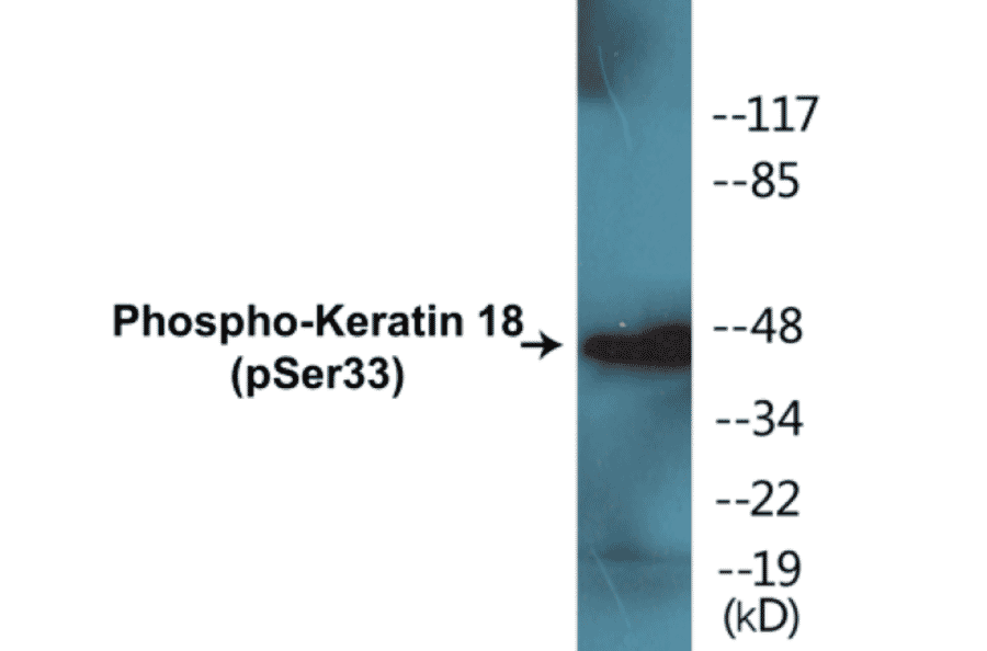 Western Blot - Keratin 18 (phospho Ser33) Cell Based ELISA Kit (CBP1016) - Antibodies.com