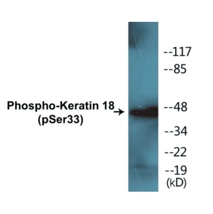 Western Blot - Keratin 18 (phospho Ser33) Cell Based ELISA Kit (CBP1016) - Antibodies.com