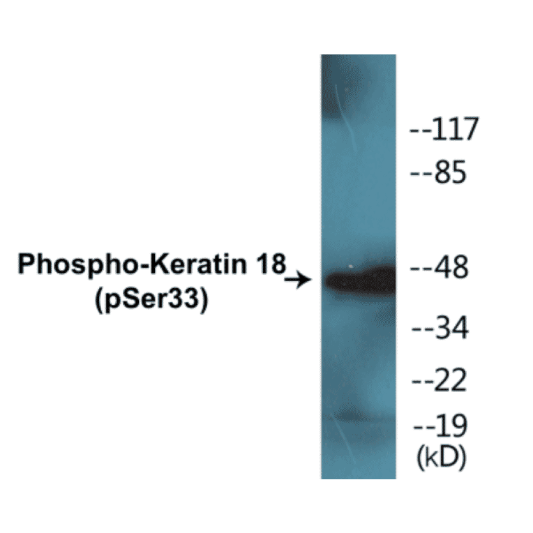 Western Blot - Keratin 18 (phospho Ser33) Cell Based ELISA Kit (CBP1016) - Antibodies.com