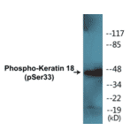 Western Blot - Keratin 18 (phospho Ser33) Cell Based ELISA Kit (CBP1016) - Antibodies.com