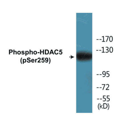 Western Blot - Histone H3 (phospho Ser28) Cell Based ELISA Kit (CBP1122) - Antibodies.com