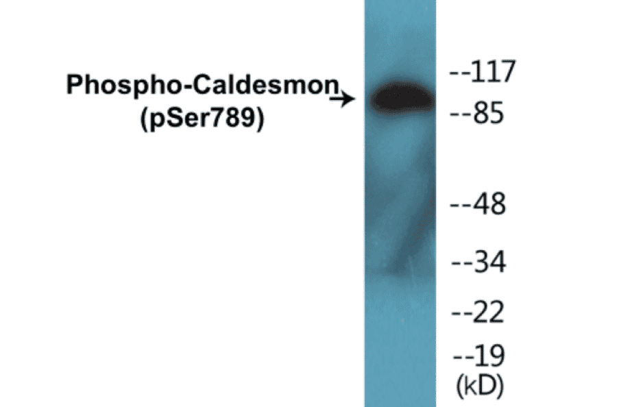 Western Blot - Caldesmon (phospho Ser789) Cell Based ELISA Kit (CBP1143) - Antibodies.com
