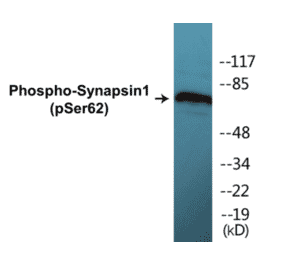 Western Blot - Synapsin 1 (phospho Ser62) Cell Based ELISA Kit (CBP1220) - Antibodies.com