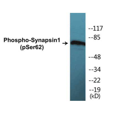 Western Blot - Synapsin 1 (phospho Ser62) Cell Based ELISA Kit (CBP1220) - Antibodies.com