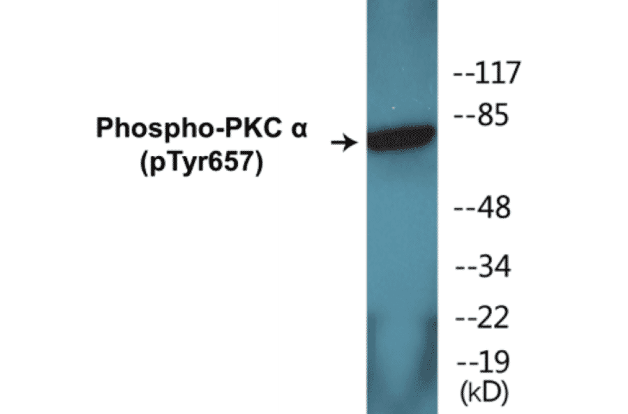Western Blot - PKC alpha (phospho Tyr657) Cell Based ELISA Kit (CBP1305) - Antibodies.com