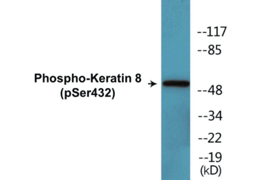 Western Blot - Keratin 8 (phospho Ser432) Cell Based ELISA Kit (CBP1355) - Antibodies.com