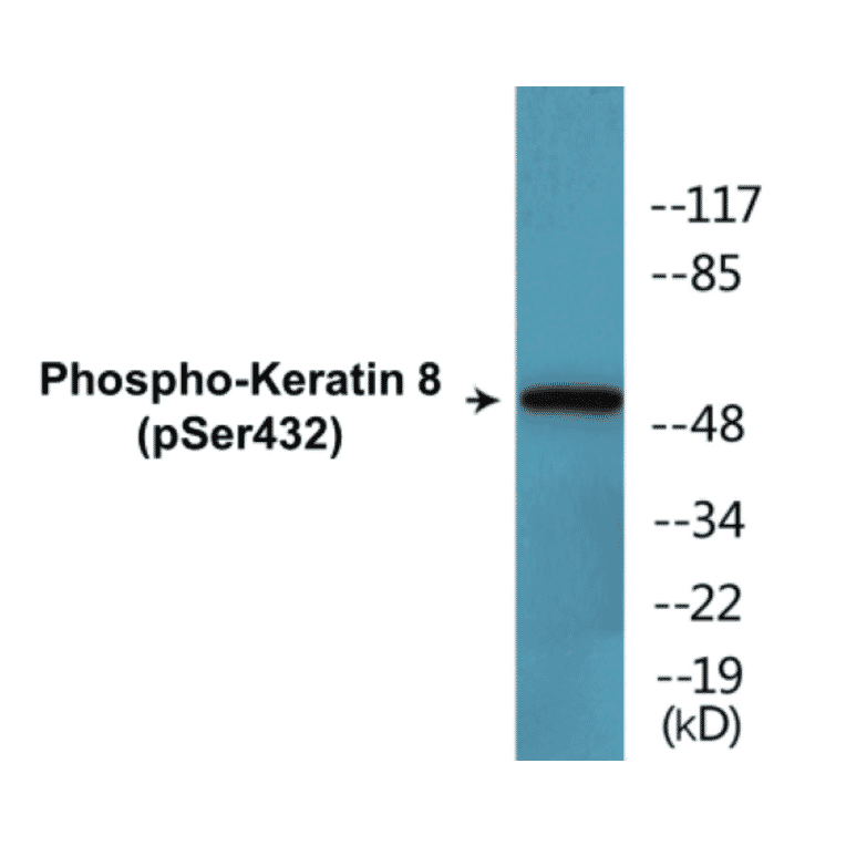 Western Blot - Keratin 8 (phospho Ser432) Cell Based ELISA Kit (CBP1355) - Antibodies.com