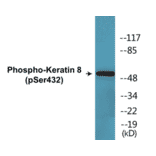 Western Blot - Keratin 8 (phospho Ser432) Cell Based ELISA Kit (CBP1355) - Antibodies.com