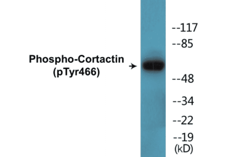 Western Blot - Cortactin (phospho Tyr466) Cell Based ELISA Kit (CBP1524) - Antibodies.com