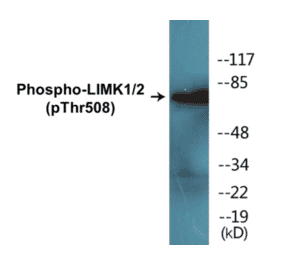 Western Blot - LIMK1 + 2 (phospho Thr508) Cell Based ELISA Kit (CBP1605) - Antibodies.com