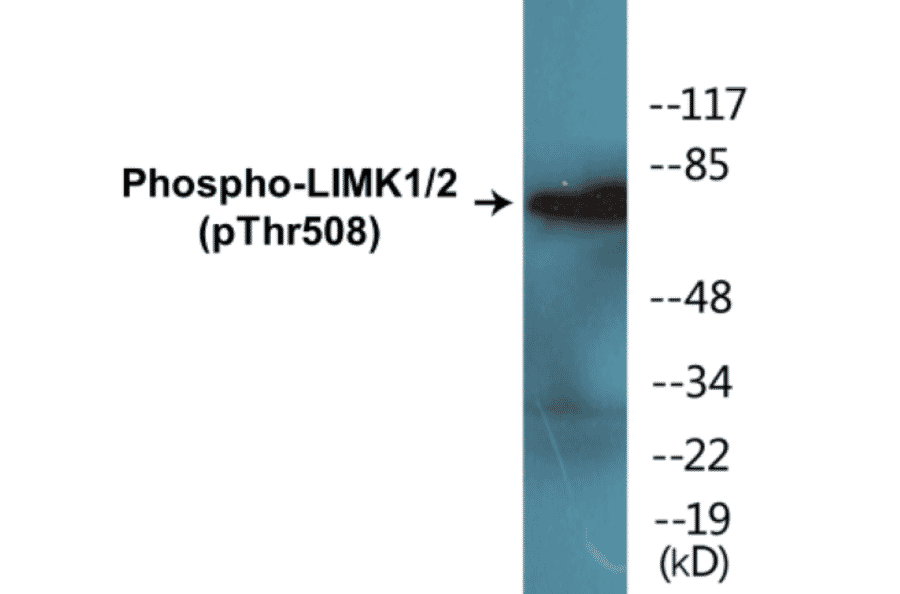Western Blot - LIMK1 + 2 (phospho Thr508) Cell Based ELISA Kit (CBP1605) - Antibodies.com