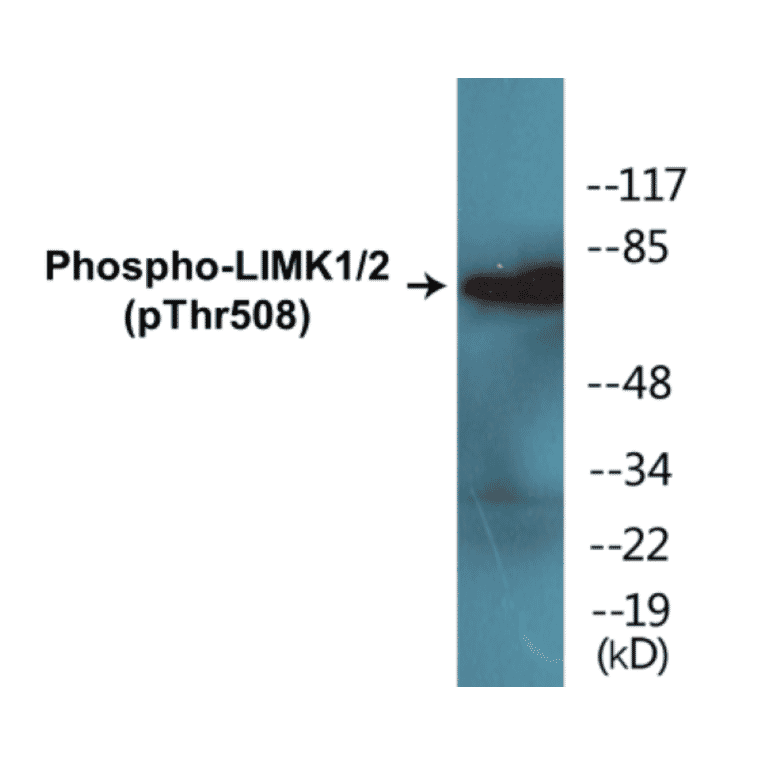 Western Blot - LIMK1 + 2 (phospho Thr508) Cell Based ELISA Kit (CBP1605) - Antibodies.com