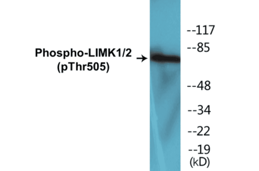 Western Blot - LIMK1 + 2 (phospho Thr505) Cell Based ELISA Kit (CBP1606) - Antibodies.com