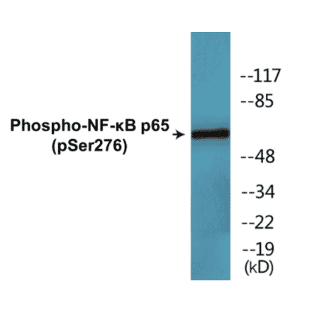 Western Blot - NF-kB p65 (phospho Ser276) Cell Based ELISA Kit (CBP1631) - Antibodies.com