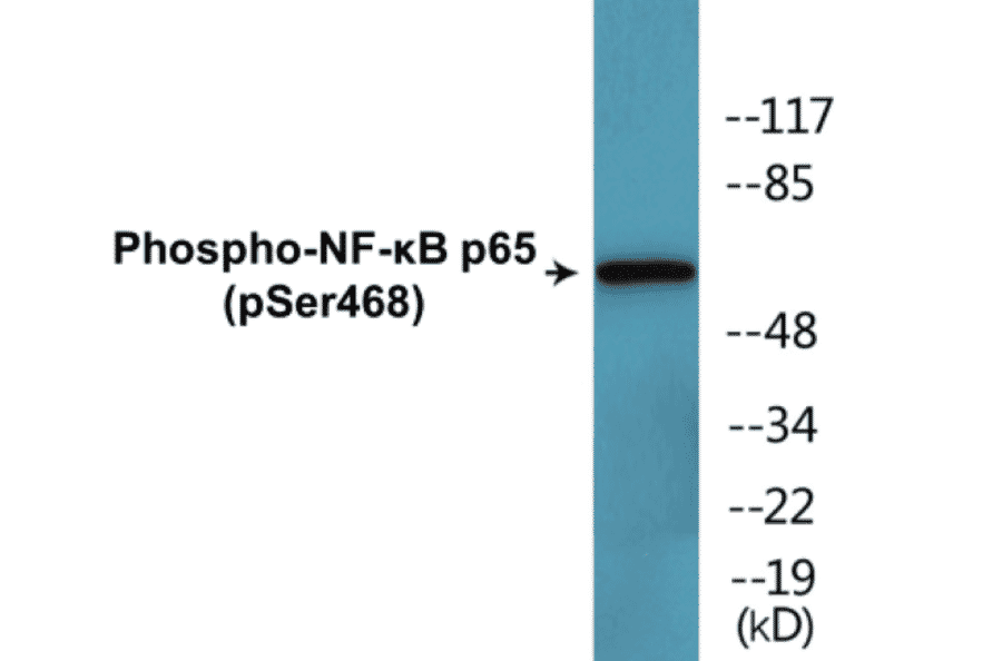 Western Blot - NF-kB p65 (phospho Ser468) Cell Based ELISA Kit (CBP1632) - Antibodies.com
