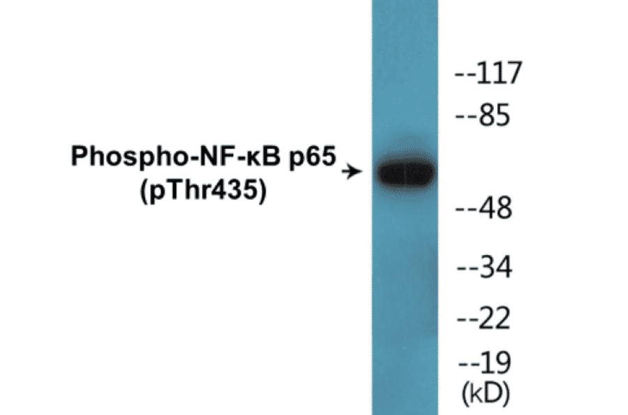 Western Blot - NF-kB p65 (phospho Thr435) Cell Based ELISA Kit (CBP1635) - Antibodies.com