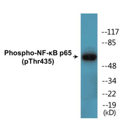 Western Blot - NF-kB p65 (phospho Thr435) Cell Based ELISA Kit (CBP1635) - Antibodies.com