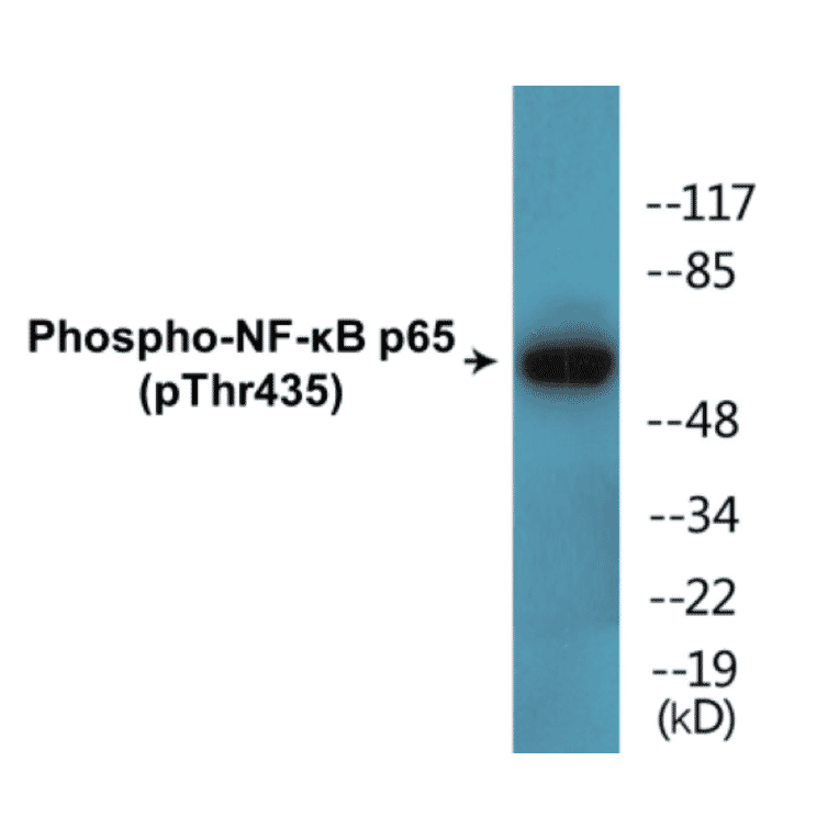 Western Blot - NF-kB p65 (phospho Thr435) Cell Based ELISA Kit (CBP1635) - Antibodies.com