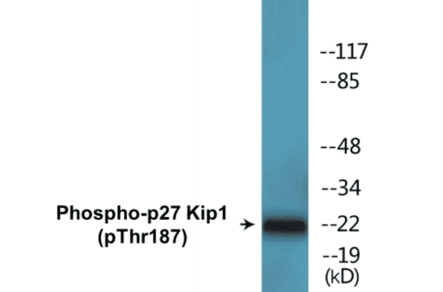 Western Blot - p27 Kip 1 (phospho Thr187) Cell Based ELISA Kit (CBP1639) - Antibodies.com