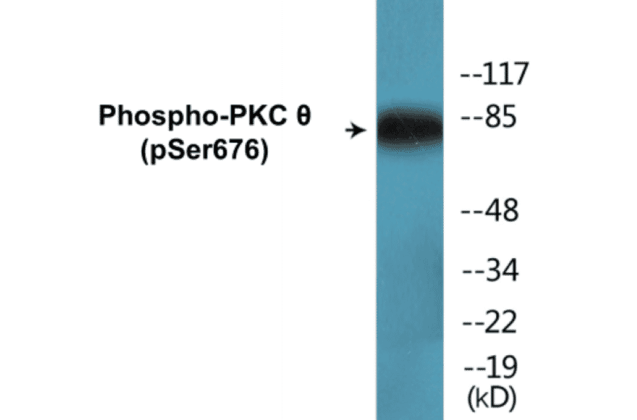 Western Blot - PKC theta (phospho Ser676) Cell Based ELISA Kit (CBP1658) - Antibodies.com