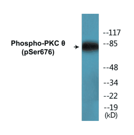 Western Blot - PKC theta (phospho Ser676) Cell Based ELISA Kit (CBP1658) - Antibodies.com