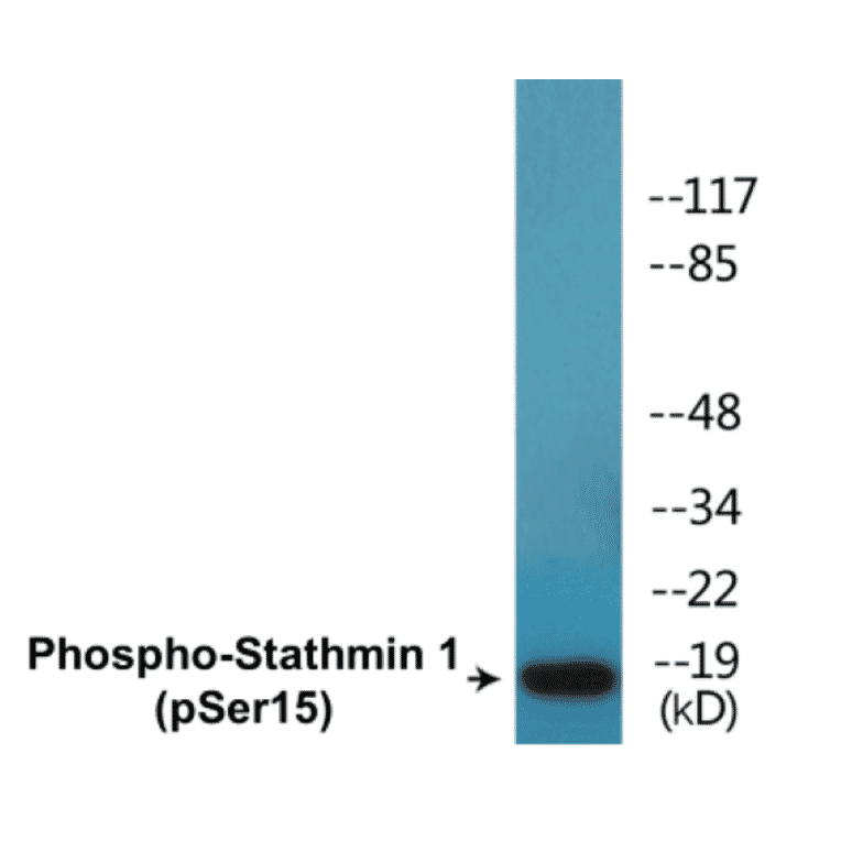 Western Blot - Stathmin 1 (phospho Ser15) Cell Based ELISA Kit (CBP1687) - Antibodies.com