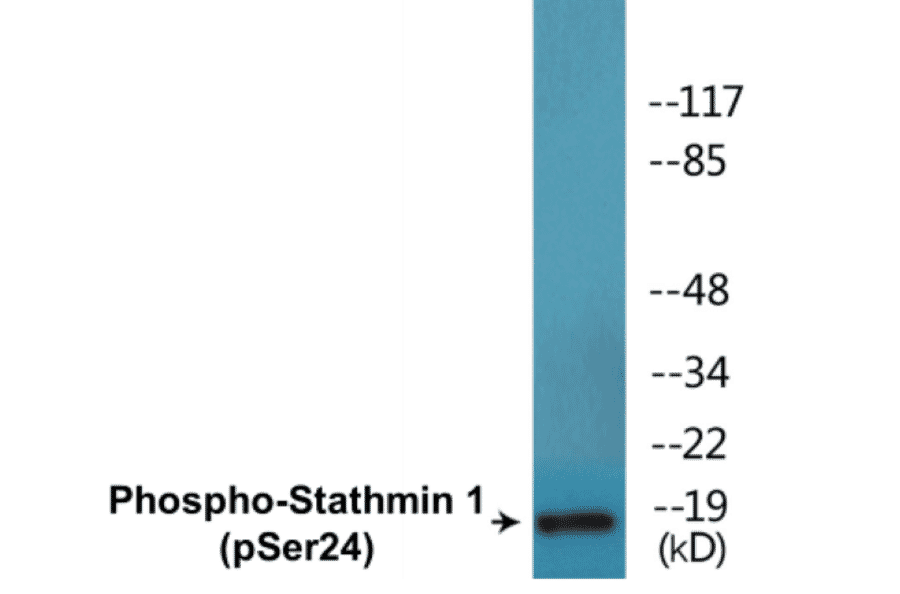 Western Blot - Stathmin 1 (phospho Ser24) Cell Based ELISA Kit (CBP1688) - Antibodies.com
