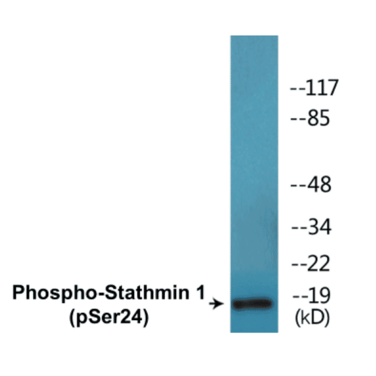 Western Blot - Stathmin 1 (phospho Ser24) Cell Based ELISA Kit (CBP1688) - Antibodies.com