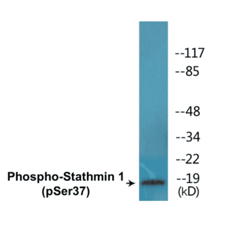Western Blot - Stathmin 1 (phospho Ser37) Cell Based ELISA Kit (CBP1689) - Antibodies.com