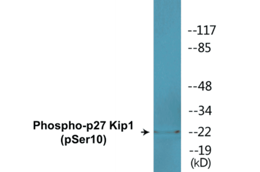 Western Blot - p27 Kip 1 (phospho Ser10) Cell Based ELISA Kit (CBP1638) - Antibodies.com