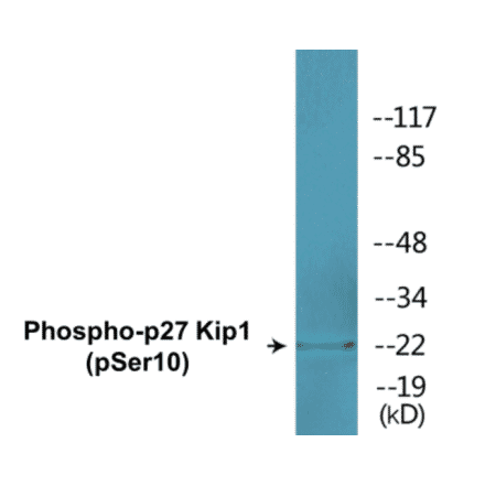 Western Blot - p27 Kip 1 (phospho Ser10) Cell Based ELISA Kit (CBP1638) - Antibodies.com