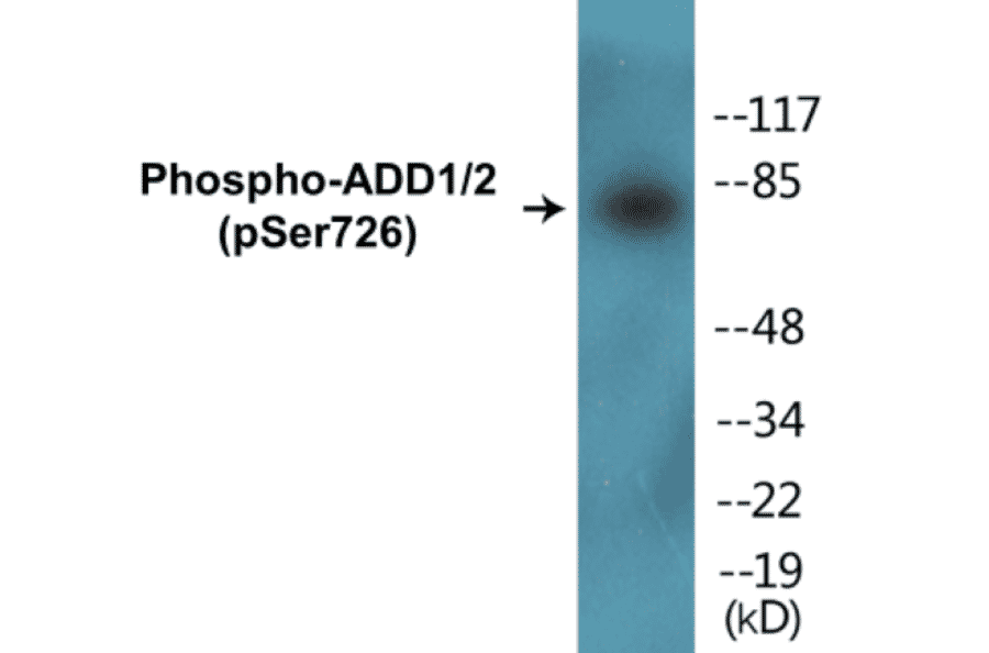 Western Blot - ADD1 + 2 (phospho Ser726) Cell Based ELISA Kit (CBP1002) - Antibodies.com