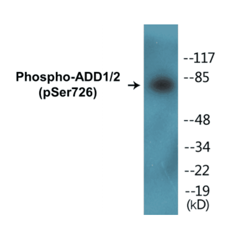 Western Blot - ADD1 + 2 (phospho Ser726) Cell Based ELISA Kit (CBP1002) - Antibodies.com