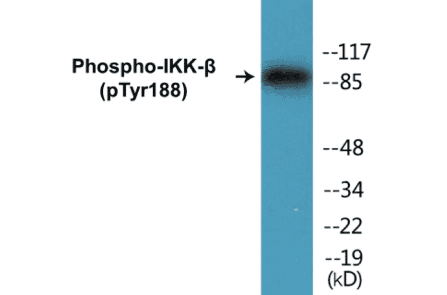 Western Blot - IKK beta (phospho Tyr188) Cell Based ELISA Kit (CBP1128) - Antibodies.com