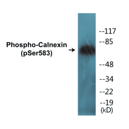 Western Blot - Calnexin (phospho Ser583) Cell Based ELISA Kit (CBP1144) - Antibodies.com