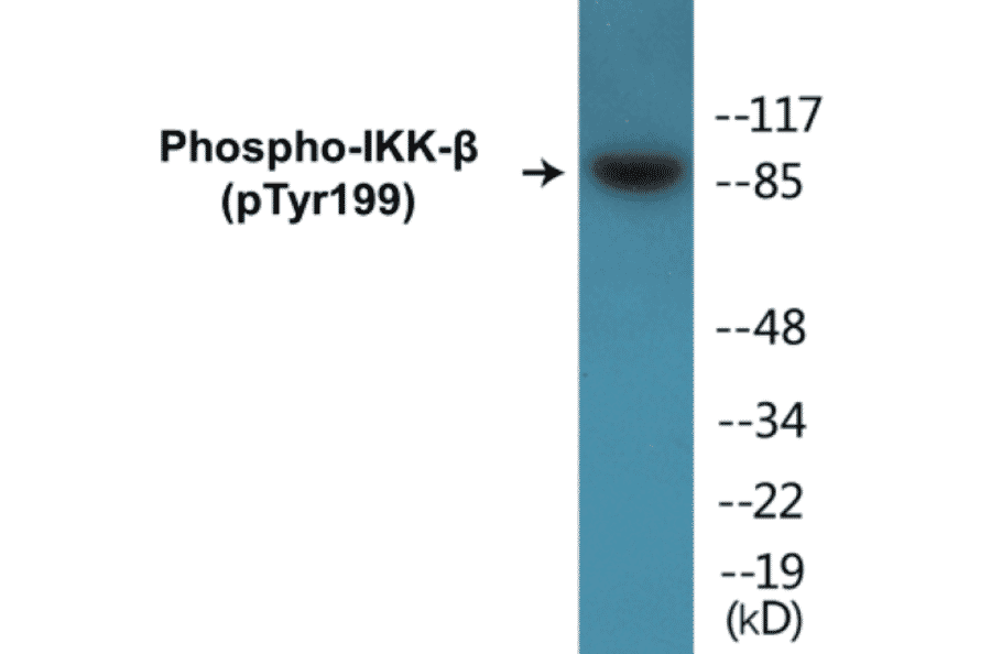 Western Blot - IKK beta (phospho Tyr199) Cell Based ELISA Kit (CBP1162) - Antibodies.com