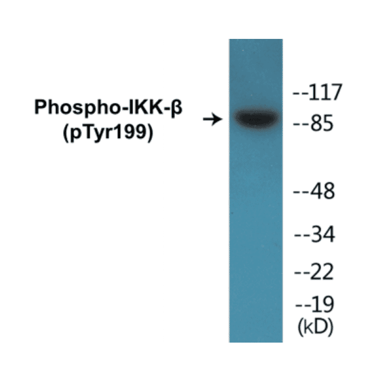 Western Blot - IKK beta (phospho Tyr199) Cell Based ELISA Kit (CBP1162) - Antibodies.com