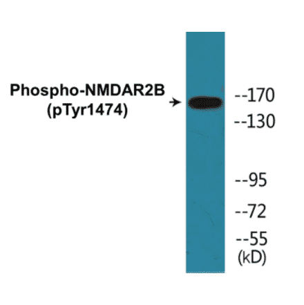 Western Blot - NMDAR2B (phospho Tyr1474) Cell Based ELISA Kit (CBP1185) - Antibodies.com